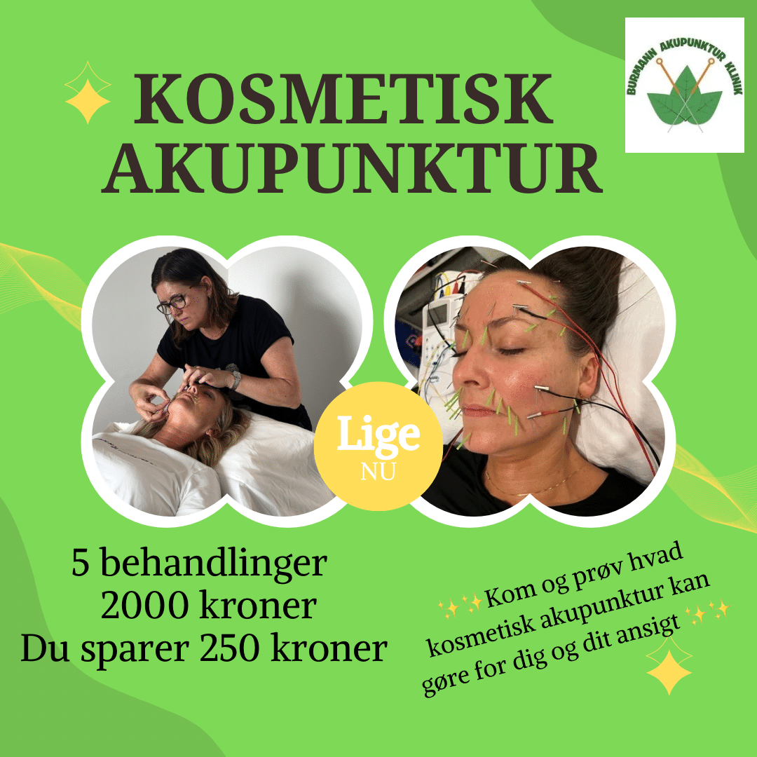 Tilbud på Kosmetisk akupunktur