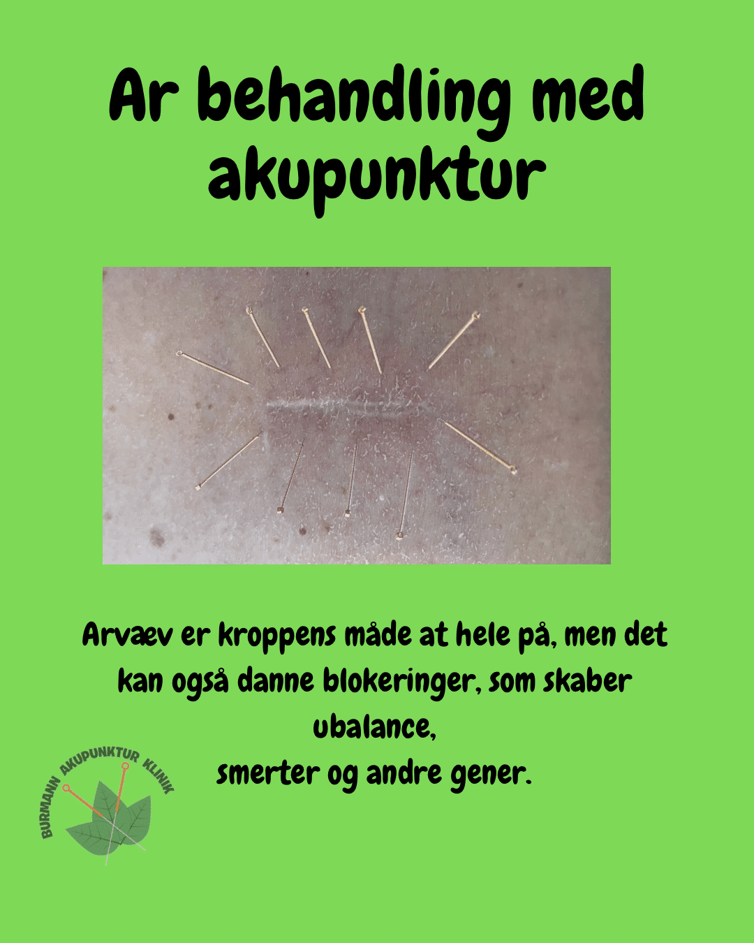 Ar - behandling